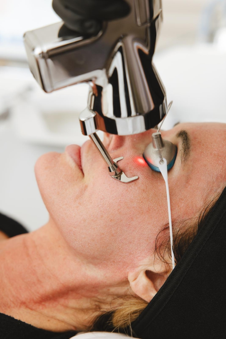 Sciton ProFractional Laser
