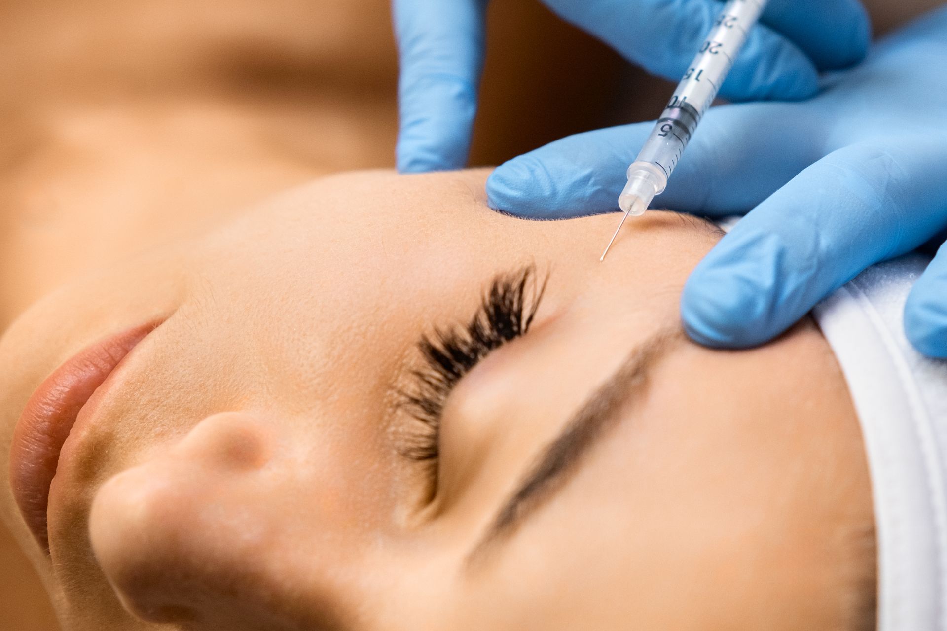 Close-up of a clinician administering a polynucleotide injection near the brow.