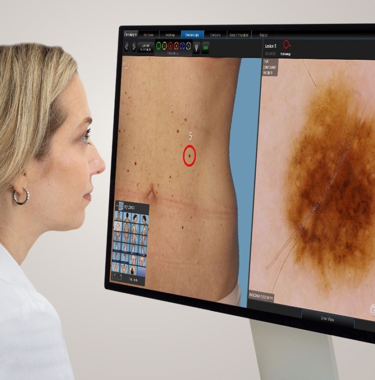 Which London Clinic Combines Mole Checks with Follow-Up Mole Removal?
