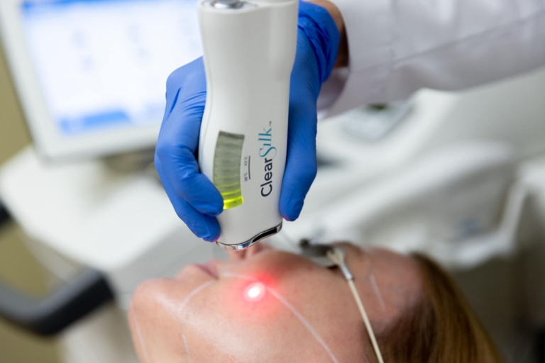 What Are the Best Laser Face Treatment Options for Skin Rejuvenation?