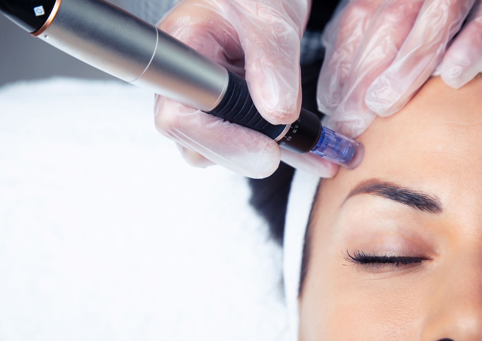 Consultant-led SkinPen microneedling treatment at Montrose London Belgravia.