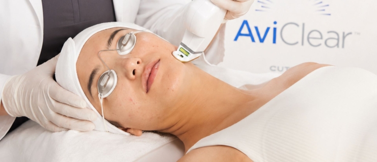 What Is the New Laser Treatment for Acne?