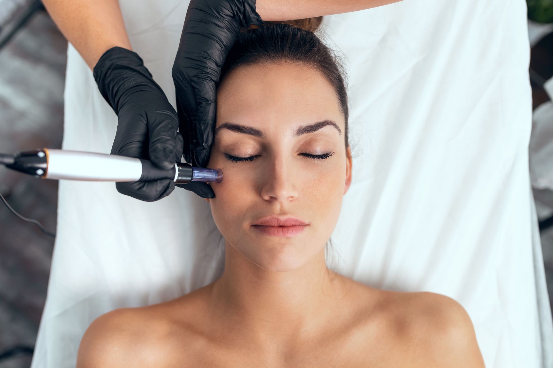 Practitioner performing a facial skin treatment on a patient. Confirm that the licensed image accurately shows the procedure before identifying it as SkinPen