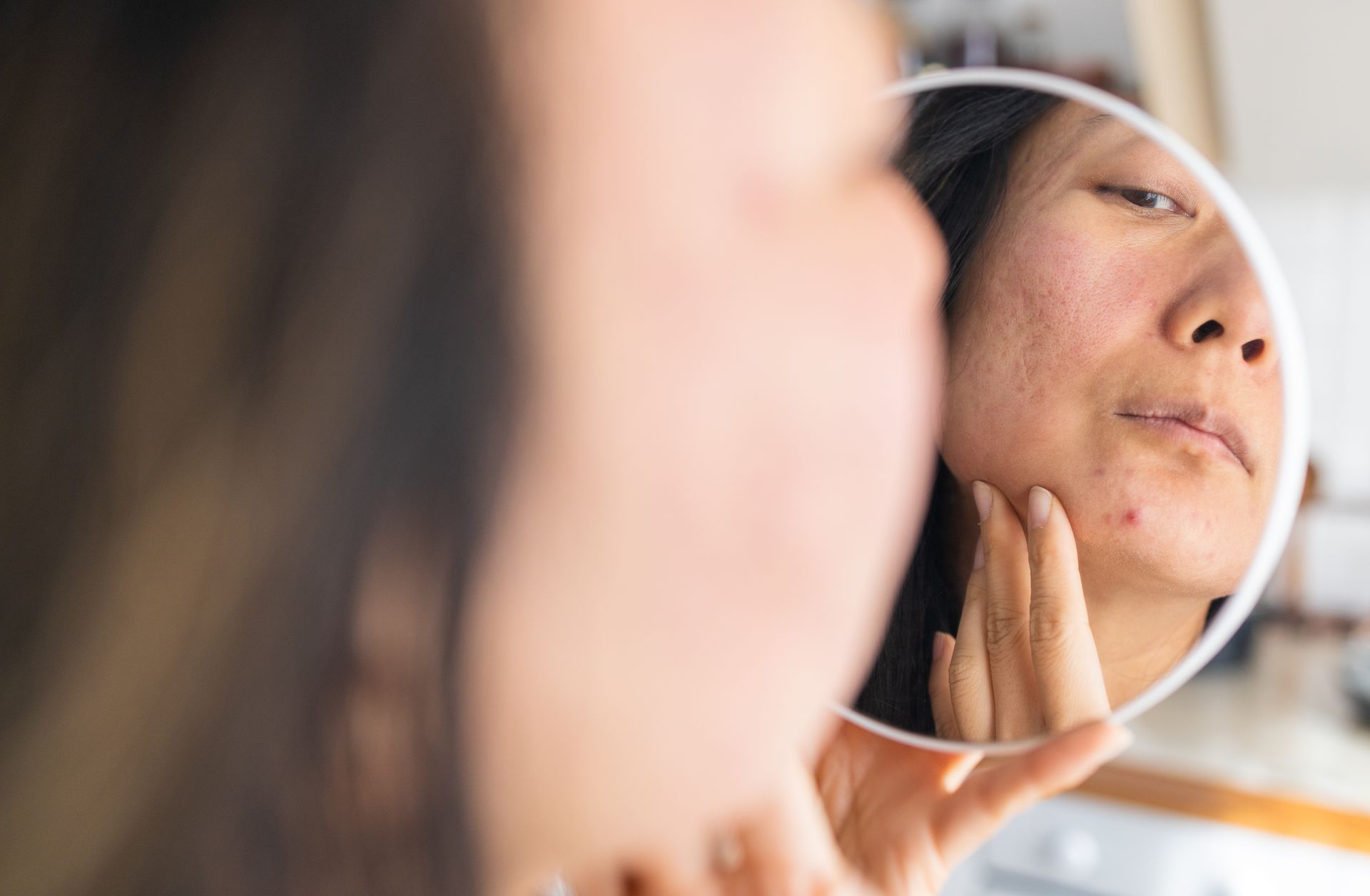 Young woman looking at her skin in a mirror.